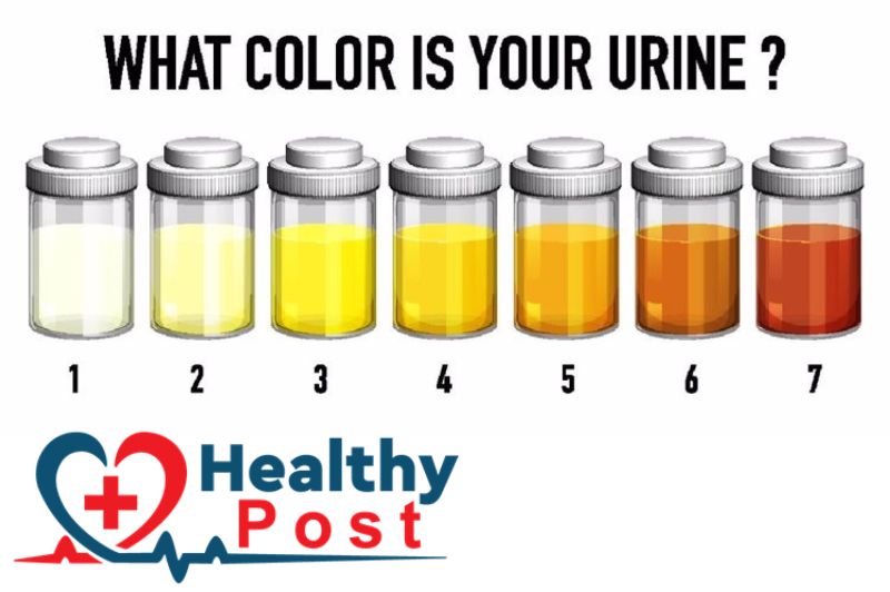 What color is your urine? 